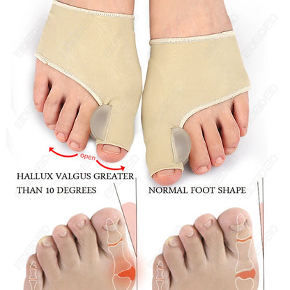 Bunion Corrector Silicone Gel | Hallux Valgus Toe Straightener & Pain Relief Sleeve - SBody Kings