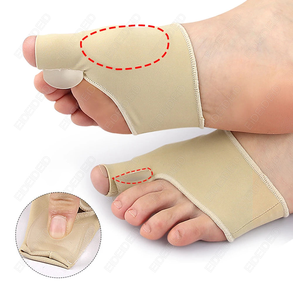 Bunion Corrector Silicone Gel | Hallux Valgus Toe Straightener & Pain Relief Sleeve - SBody Kings